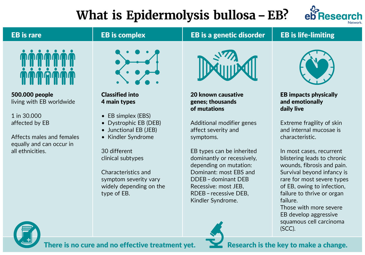 Graphic explaining what EB is.