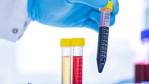 Three pipettes with different liquids - one pipette is lifted by one hand