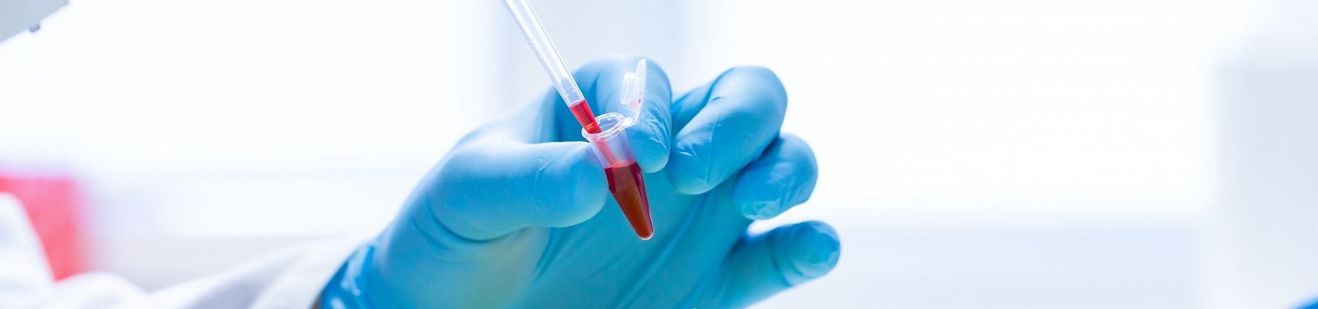 Researcher's hands in blue gloves pipette red liquid