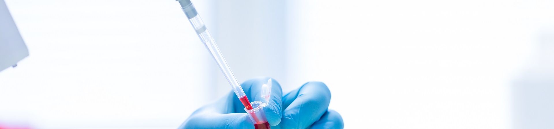 Researcher's hands in blue gloves pipette red liquid