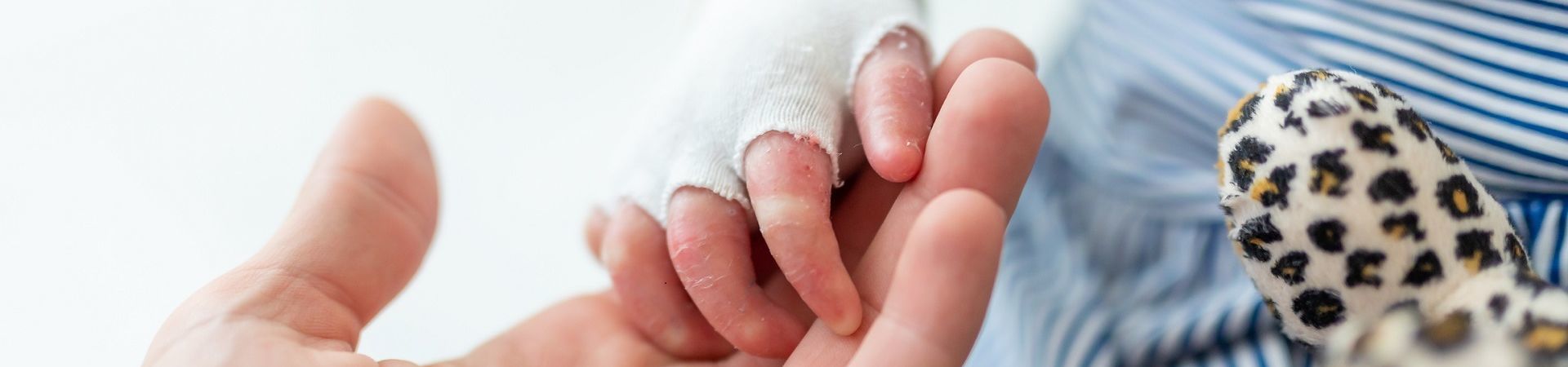 EB child's hand with a male hand