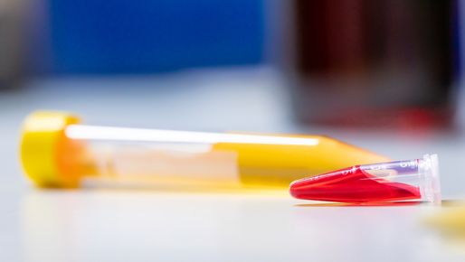 Two pipettes with yellow and blue liquides.