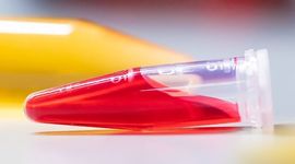 Two pipettes with yellow and red liquide on a white table.