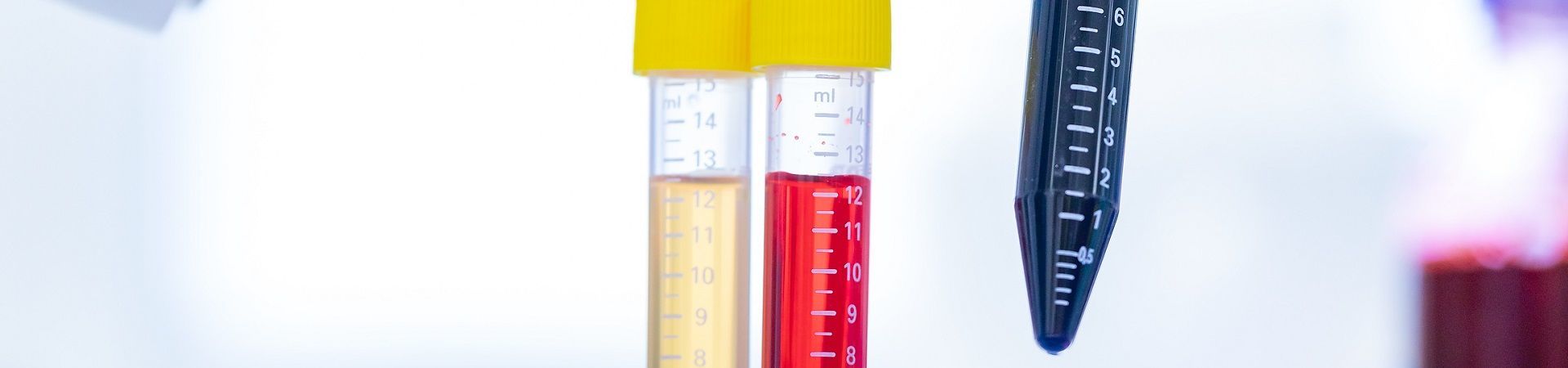 Three pipettes with colored liquides, one is lifted up by a hand wearing blue gloves.