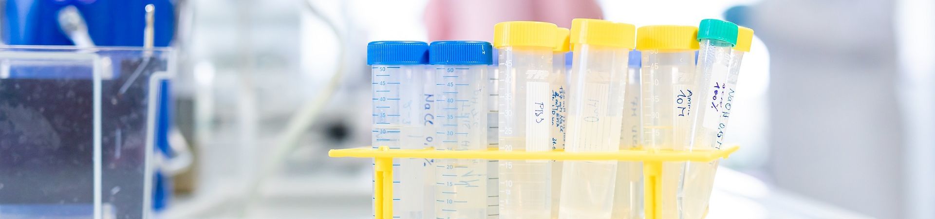 Empty pipettes in an EB lab.