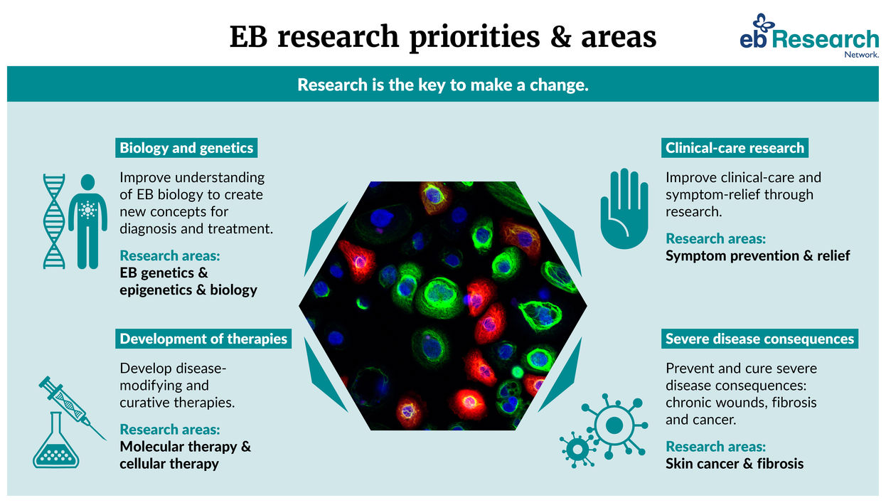 Graphic explaining 4 current research priorities and areas EB-ResNet