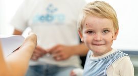 EB Patient smiles at camera