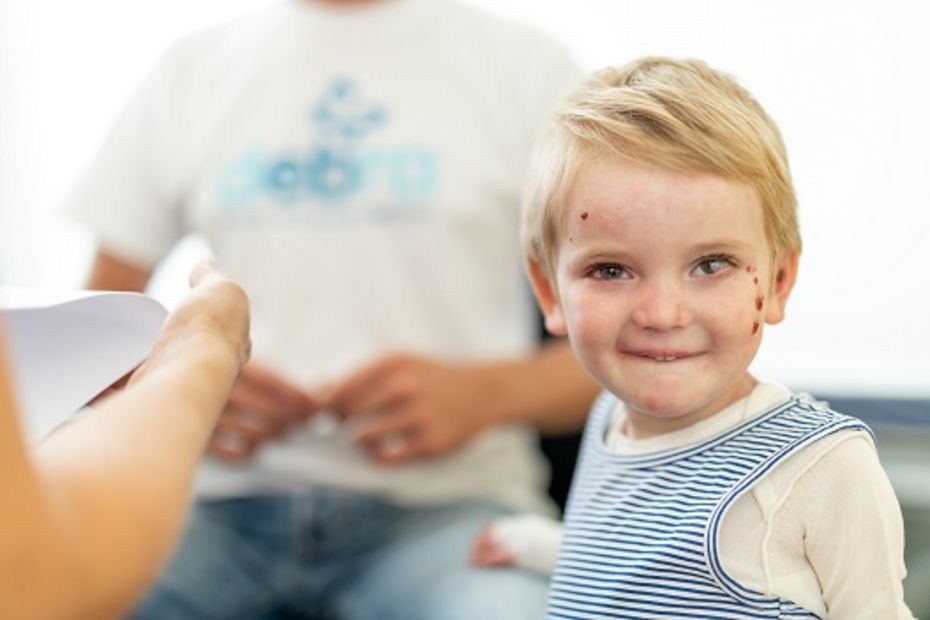 EB Patient smiles at camera